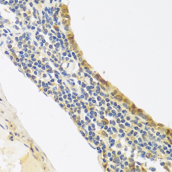 Endothelin 1 Antibody