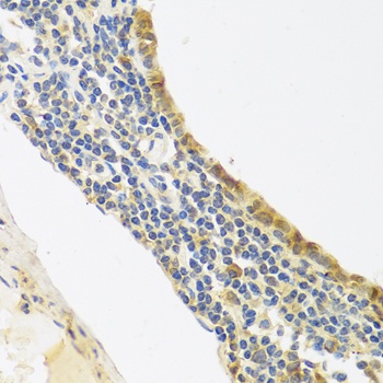 EDN1 Antibody