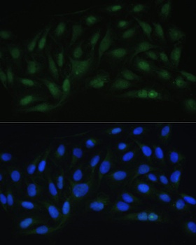 Endothelin 1 Antibody
