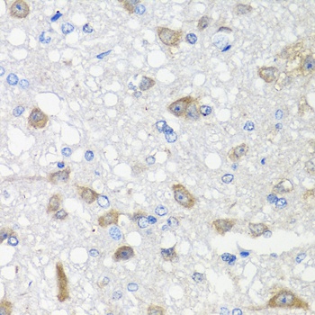 ACVR1C Antibody