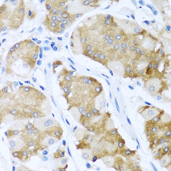 ACVR1C Antibody