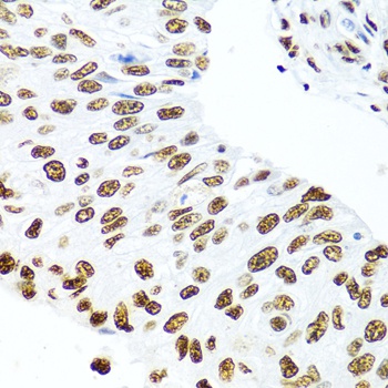 SSB Antibody