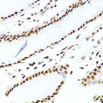SSB Antibody