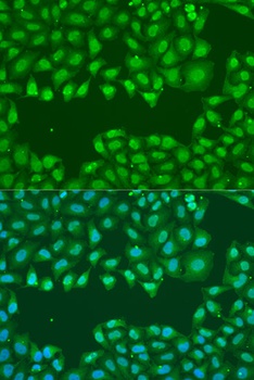 SSB Antibody