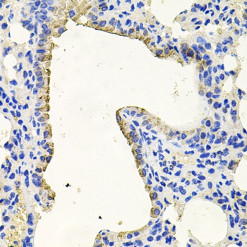 PKN1 Antibody