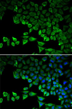 RIG-I / DDX58 Antibody