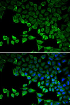 DDX58 Antibody