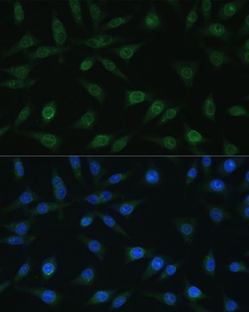 NUP98 Antibody