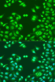 NUMA1 Antibody