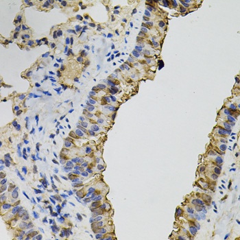 DNM2 Antibody