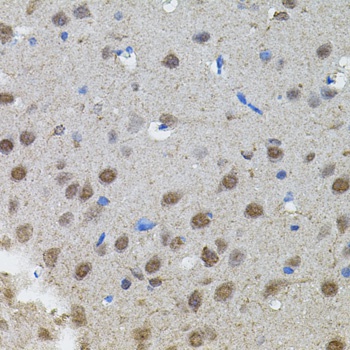 MYCN Antibody