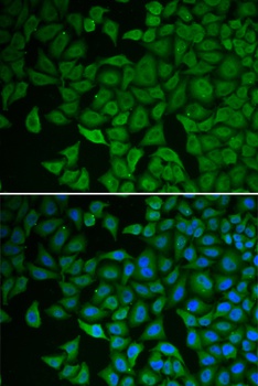 CHEK2 Antibody