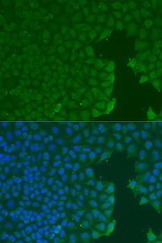 PECAM1 Antibody