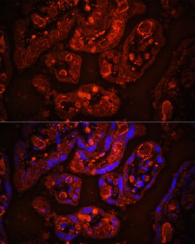 PECAM1 Antibody
