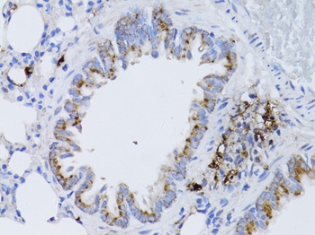 RARA Antibody
