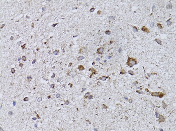 RARA Antibody
