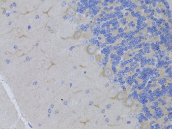 RARA Antibody