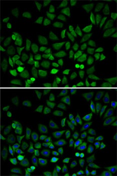 CDK4 Antibody