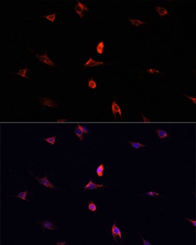 CDK4 Antibody