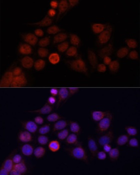 CD4 Antibody