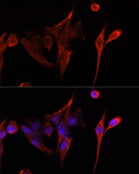 CD4 Antibody