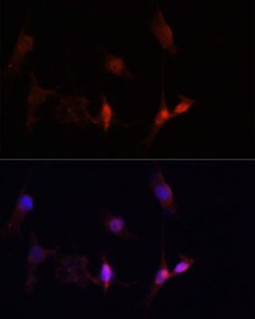 CD4 Antibody