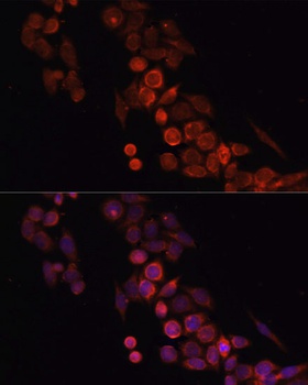 CD4 Antibody