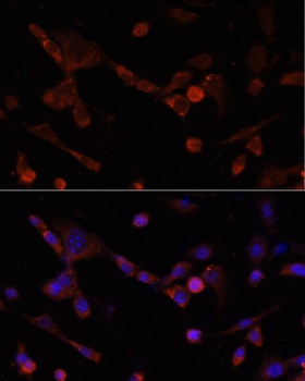 CD4 Antibody