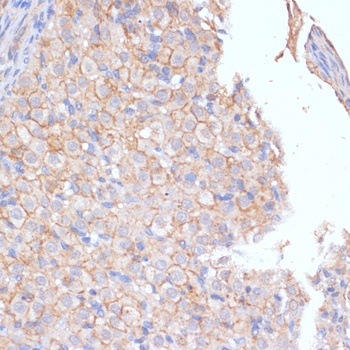 KIT Antibody