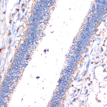 CD44 Antibody