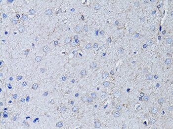 RYR2 Antibody