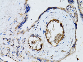 RYR2 Antibody