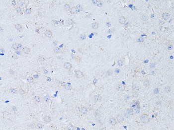 RYR2 Antibody