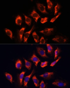 RYR2 Antibody