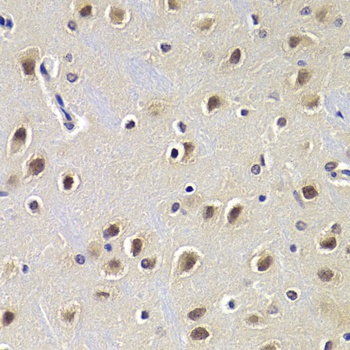CDKN1B Antibody