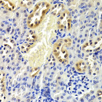 CDKN1B Antibody