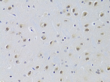 CDKN1B Antibody