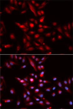 CDKN1B Antibody