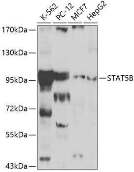 STAT5B Antibody