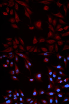 STAT5B Antibody