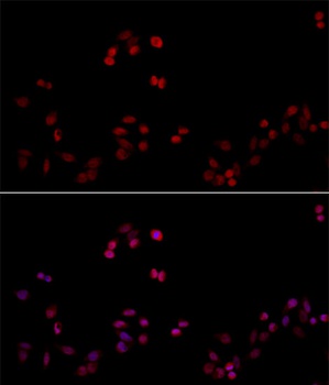 PCNA Antibody