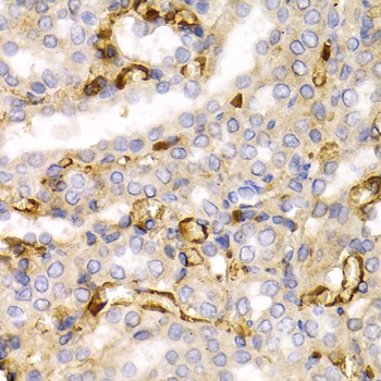 NEFL Antibody