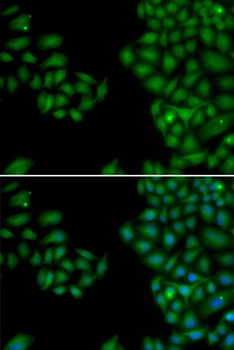 NEFL Antibody