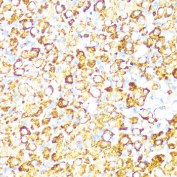 PBEF / NAMPT Antibody