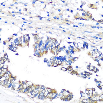 PBEF / NAMPT Antibody