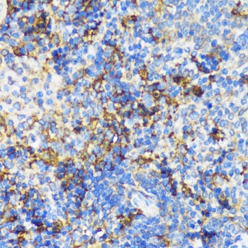 PBEF / NAMPT Antibody