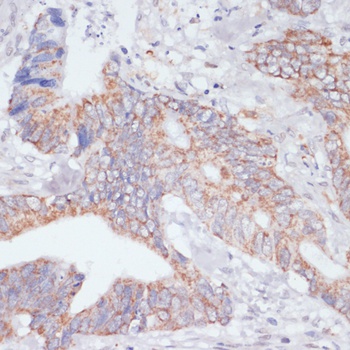 IKBKE Antibody