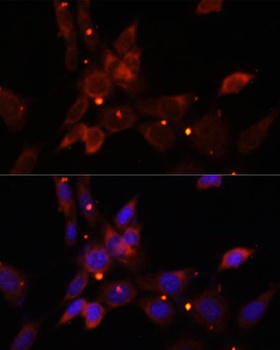 IKBKE Antibody