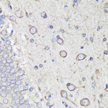 HSPA5 Antibody