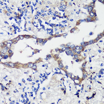 HSPA5 Antibody